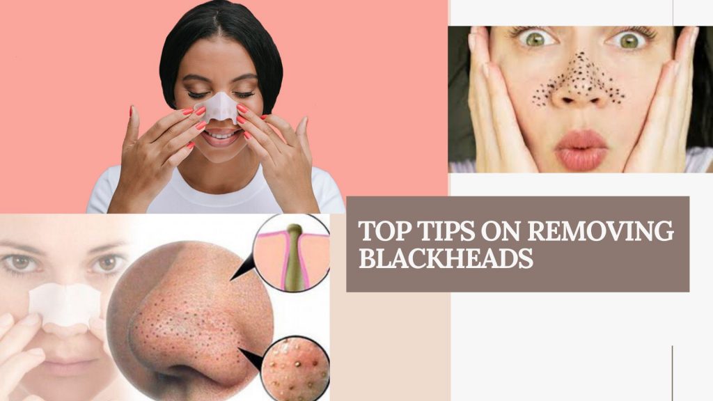 blackheads removing tips