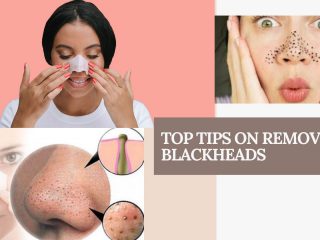 blackheads removing tips